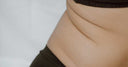 insulin-resistance-insuline-resistentie
