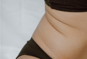 insuline-resistentie-insulin-resistance